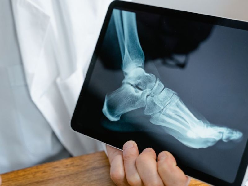 Orthopaedic Hospitals in Chengalpattu with Free CMCHIS&nbsp;Treatment