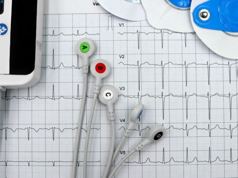 Cardiology & Heart Hospitals in Chennai under CMCHIS– Free Heart Treatment with Health&nbsp;Insurance